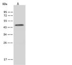 ZNF766 Antibody in Western Blot (WB)