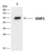SNIP1 Antibody in Immunoprecipitation (IP)