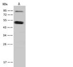 SNIP1 Polyclonal Antibody