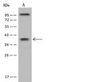 ST6GALNAC5 Polyclonal Antibody