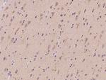 SYT11 Antibody in Immunohistochemistry (Paraffin) (IHC (P))