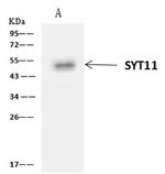 SYT11 Antibody in Immunoprecipitation (IP)