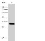 TM2D2 Polyclonal Antibody