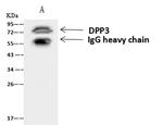 DPP3 Antibody in Immunoprecipitation (IP)
