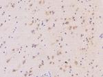 MRPS25 Antibody in Immunohistochemistry (Paraffin) (IHC (P))