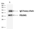 PDLIM1 Antibody in Immunoprecipitation (IP)