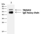 TROVE2 Antibody in Immunoprecipitation (IP)