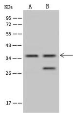 TSEN34 Polyclonal Antibody