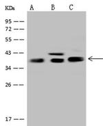 Aldolase C Polyclonal Antibody