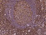 ADAP Polyclonal Antibody