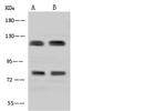 ADAP Antibody in Western Blot (WB)