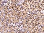 SBCAD Polyclonal Antibody