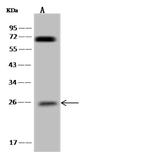 COPZ2 Antibody in Western Blot (WB)