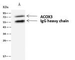 ACOX3 Antibody in Immunoprecipitation (IP)