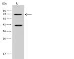 ACOX3 Polyclonal Antibody
