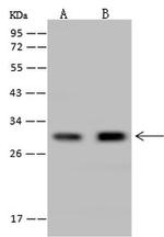 CUTC Antibody in Western Blot (WB)