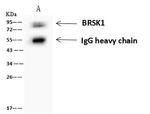BRSK1 Antibody in Immunoprecipitation (IP)