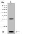 DPM2 Polyclonal Antibody