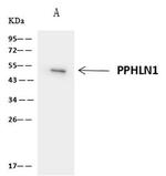 PPHLN1 Antibody in Immunoprecipitation (IP)