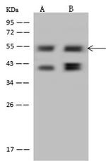 PPHLN1 Antibody in Western Blot (WB)