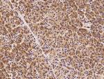 Dynactin 3 Antibody in Immunohistochemistry (Paraffin) (IHC (P))