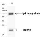 Dynactin 3 Antibody in Immunoprecipitation (IP)