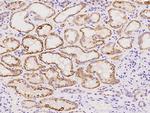 DHRS4 Polyclonal Antibody