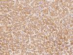 DHRS4 Antibody in Immunohistochemistry (Paraffin) (IHC (P))
