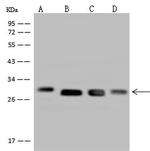 DHRS4 Antibody in Western Blot (WB)