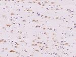 RPL14 Antibody in Immunohistochemistry (Paraffin) (IHC (P))