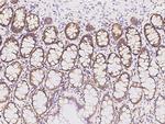 RPL14 Polyclonal Antibody