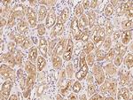 SHISA5 Polyclonal Antibody