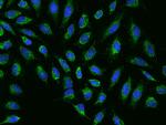 NDUFB7 Polyclonal Antibody