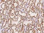 NDUFB7 Antibody in Immunohistochemistry (Paraffin) (IHC (P))