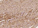 NDUFB7 Antibody in Immunohistochemistry (Paraffin) (IHC (P))