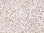 KHSRP Antibody in Immunohistochemistry (Paraffin) (IHC (P))
