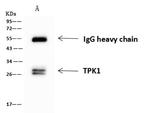 TPK1 Antibody in Immunoprecipitation (IP)