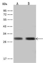 TPK1 Antibody in Western Blot (WB)