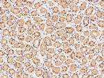 MYST2 Antibody in Immunohistochemistry (Paraffin) (IHC (P))