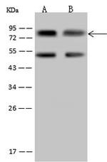 MYST2 Antibody in Western Blot (WB)