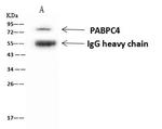 PABPC4 Antibody in Immunoprecipitation (IP)