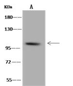 B4GALNT3 Polyclonal Antibody