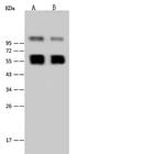 West Nile Virus NS1 (lineage 1, strain NY99) Polyclonal Antibody