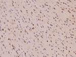 Neuroserpin Polyclonal Antibody
