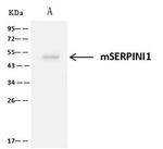 Neuroserpin Antibody in Immunoprecipitation (IP)
