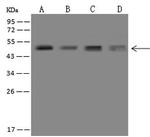 Neuroserpin Antibody in Western Blot (WB)
