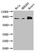 ABLIM1 Polyclonal Antibody
