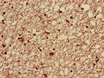 ABT1 Antibody in Immunohistochemistry (Paraffin) (IHC (P))