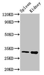 ABT1 Antibody in Western Blot (WB)