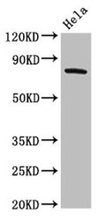 GRK3 Antibody in Western Blot (WB)